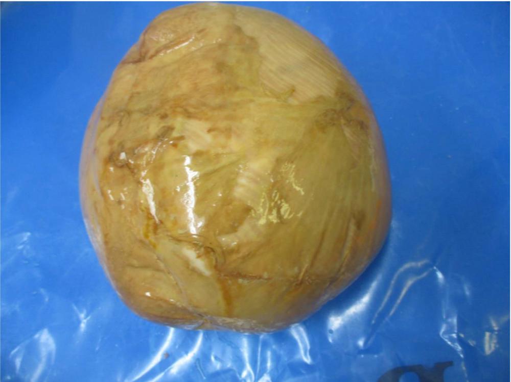 Product gallery 615473682